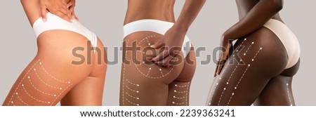 Young diverse women in bikini with perfect skin, slim body with lines for figure shaping or drainage massage isolated on gray background, studio. Contouring plastic surgery, fit results and body care Royalty-Free Stock Photo #2239363241
