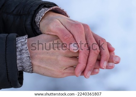Frozen women's hands.The girl is trying to warm her frozen in the cold hands.Care for the skin of the hands in the winter. Royalty-Free Stock Photo #2240361807