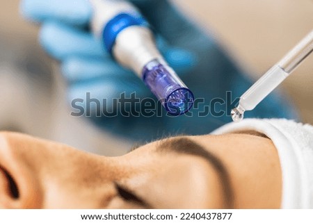 Cosmetician makes microneedling, care to the patient using dermapen in a cosmetology salon.  Royalty-Free Stock Photo #2240437877