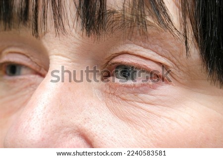 Portrait of wrinkled face of elderly mature older middle aged woman, close up of beautiful female eyes with dry skin.cosmetology care treatment,age skin care beauty cream,medicine,plastic surgery Royalty-Free Stock Photo #2240583581