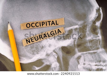 Medical concept. On x-rays of a human skull, a pencil and strips of paper with the inscription - Occipital neuralgia Royalty-Free Stock Photo #2240921513