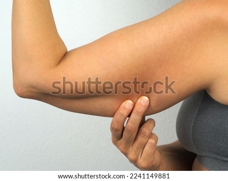 Woman grabbing skin on her upper arm with excess fat.The problem of overweight  and weak triceps muscles. Close-up photo on white background. Royalty-Free Stock Photo #2241149881