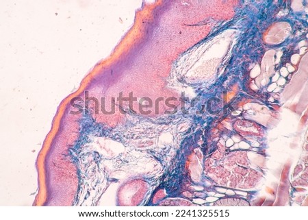 Lung and Pituitary gland Human under the microscope in Lab.