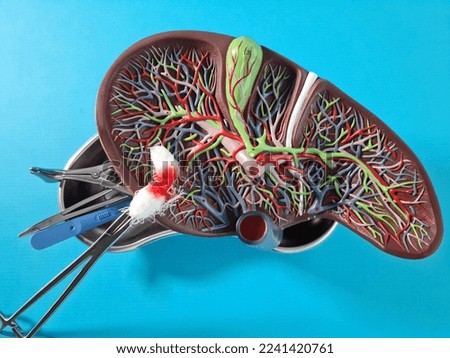 Liver resection for cancer and general principles of liver surgery concept Royalty-Free Stock Photo #2241420761