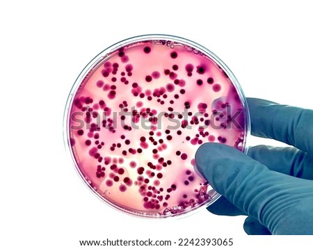 Isolated dark red and pink colonies of mixed bacteria such as E. coli, Salmonella or Enterobacteriaceae that growing on red agar plate  Royalty-Free Stock Photo #2242393065