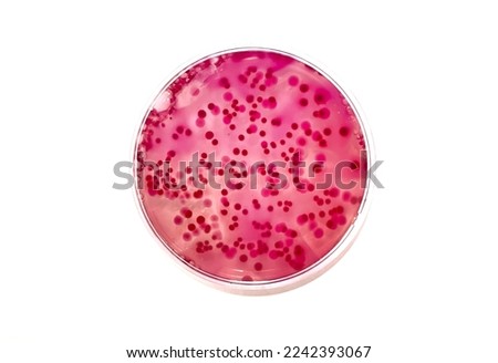 Dark red and pink colonies of mixed bacteria growing on red agar plate  Royalty-Free Stock Photo #2242393067