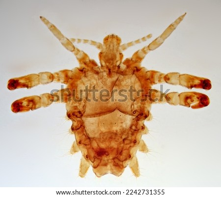 Pubic louse (Pthirus pubis) under microscope