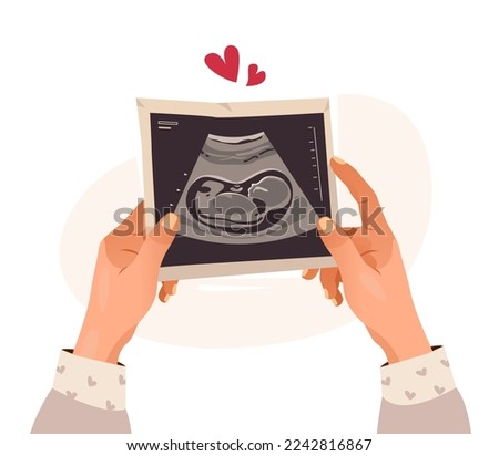 Hands holding a photo of a baby on ultrasound scan in the womb. Ultrasound of the child. Pregnancy. Cartoon vector illustration Royalty-Free Stock Photo #2242816867