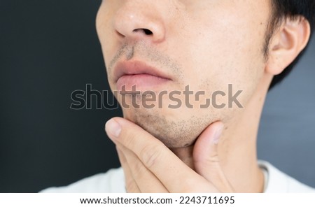 Beard of a man in his 30s before hair removal Royalty-Free Stock Photo #2243711695