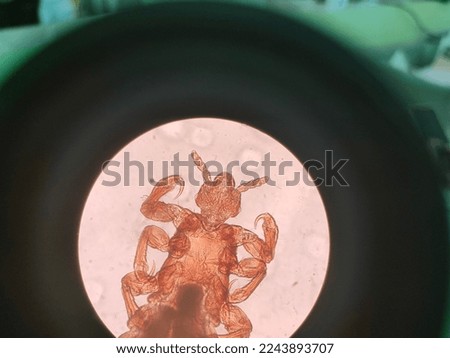 Head lice zoom in microscope 40x magnification
