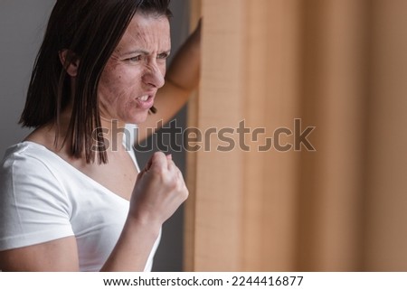 Photo of woman with dry skin looking in the window.