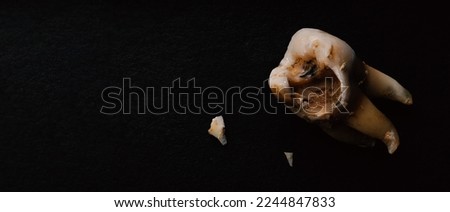 Tooth decay on black background. Macro shot of a decayed teeth till root after extraction of dentist. Real tooth anatomy due lack of care. Top view of caries teeth texture on black paper. Dental care. Royalty-Free Stock Photo #2244847833