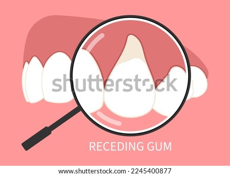 injury teeth pain dentistry crown prep cosmetic recontouring procedure oral recession gummy smile root canal decay toothache swelling grafting for buildup Loose black cavity abscess thin Royalty-Free Stock Photo #2245400877