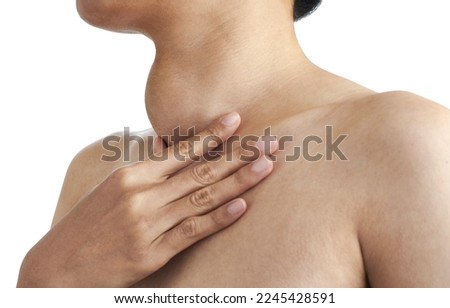 Enlarged thyroid gland, Woman palpation her neck, Woman with enlarged thyroid gland on white background Royalty-Free Stock Photo #2245428591