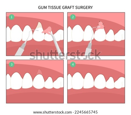 Dentistry crown prep cosmetic recontouring procedure oral teeth pain recession gummy smile root canal decay toothache swelling grafting for buildup Loose black cavity abscess thin injury Royalty-Free Stock Photo #2245665745