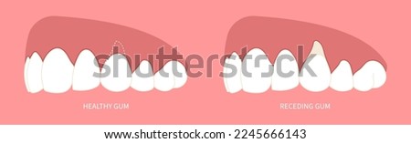 Oral teeth pain recession gummy smile dentistry root canal decay toothache swelling grafting procedure for buildup Loose black cavity abscess thin injury cosmetic recontouring crown prep Royalty-Free Stock Photo #2245666143