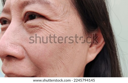 portrait the flabbiness adipose sagging skin around the eyes, ptosis and flabby skin beside the eyelid, cellulite and bag under the eyes, dark spots and rough skin on the face of woman's. Royalty-Free Stock Photo #2245794145