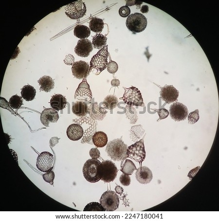 Microscopic skeleton of protozoan Radiolaria. Radiolarians, also called Radiozoa. protozoa. mineral skeletons. zooplankton under microscope. Royalty-Free Stock Photo #2247180041