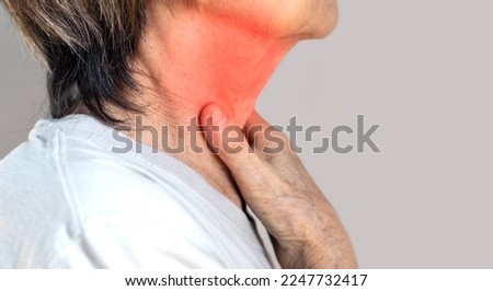 Redness at the neck of Asian, Myanmar woman. Concept of sore throat, pharyngitis, laryngitis, esophagitis, thyroiditis, or dysphagia. Royalty-Free Stock Photo #2247732417