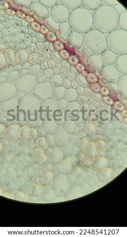 Lily of the valley rhizome structure under a microscope