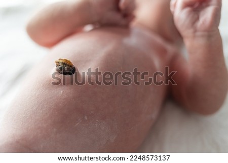 Little navel or umbilical cord newborn baby belly Royalty-Free Stock Photo #2248573137