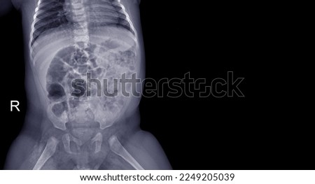 
X-ray of a 6 month old baby's torso showing inside. Royalty-Free Stock Photo #2249205039