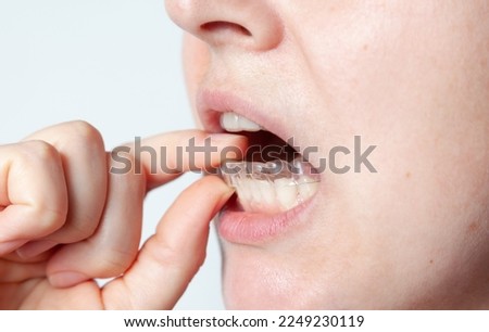 A woman gently puts a plastic retention cap on her lower teeth with her fingers. Woman face and mouth close-up on a gray background



 Royalty-Free Stock Photo #2249230119