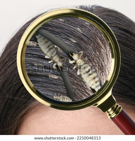 Pediculosis. Woman with lice and nits, closeup. View through magnifying glass on hair