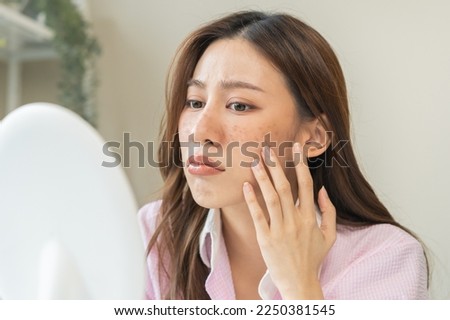 Dermatology, expression face worry, stressed asian young woman hand touching facial at dark spot of melasma, freckles from pigment melanin, allergy sun. Beauty care, skin problem treatment, skincare. Royalty-Free Stock Photo #2250381545
