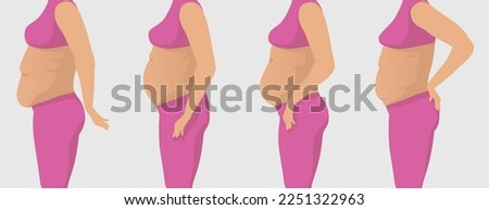 Vector illustration of fat women with different types of belly Royalty-Free Stock Photo #2251322963