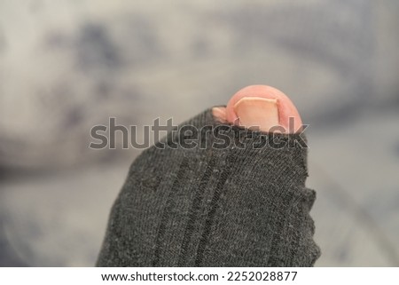 Hole in gray sock shows big toe