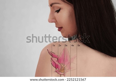 Laser Tattoo Removal On Woman's Shoulder. Medical Treatment Royalty-Free Stock Photo #2252121567