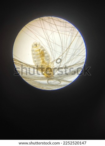 the appearance of a louse as seen through magnifying binoculars
