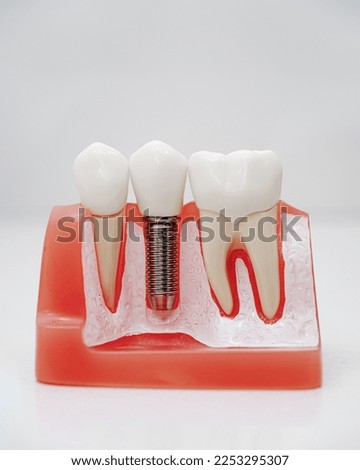 real teeth model on a light background