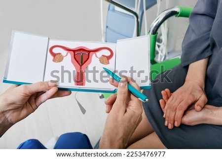 IUD. Experienced gynecologist showing female patient intrauterine contraceptive device or coil to prevent pregnancy while consultation Royalty-Free Stock Photo #2253476977