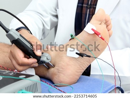 Somatosensory Evoked Potentials (SEP) or Nerve Conduction Velocity (NCV) is a test of electrical signals through a nerve, done in conjunction with an electromyography (EMG) to check the muscles Royalty-Free Stock Photo #2253714605