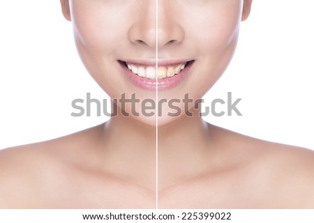 picture of beautiful woman with white teeth. woman teeth before and after whitening. Over white background