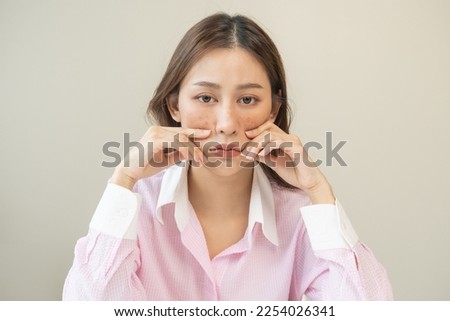 Dermatology, expression face worry, stressed asian young woman hand touching facial at dark spot of melasma, freckles from pigment melanin, allergy sun. Beauty care, skin problem treatment, skincare. Royalty-Free Stock Photo #2254026341
