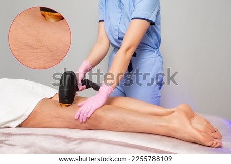 Professional cosmetologist in pink gloves does laser hair removal on female hairy legs. The concept of salon care.