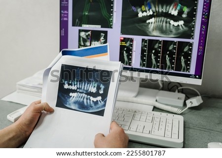 X-ray image on display on a computer screen to patients. Doctor presenting photo with tooth x-ray film recommend patient in treatment of dental and dentistry. Preparation for prosthetic teeth. Closeup