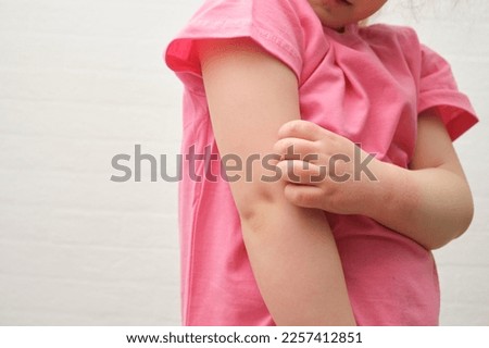 The child scratches atopic skin. Dermatitis, diathesis, allergy on the child's body.irritation and pruritus. Royalty-Free Stock Photo #2257412851