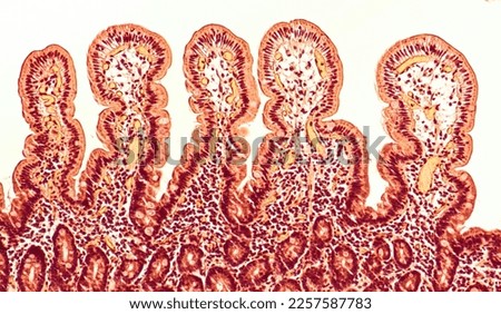 he villi of the small intestine project into the intestinal cavity. Royalty-Free Stock Photo #2257587783