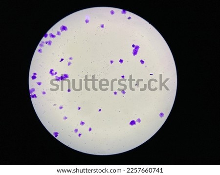 View in microscopic of dog vaginal smear cells.Squamous epithelium cells.Superficial and intermediate epithelial cells. Royalty-Free Stock Photo #2257660741
