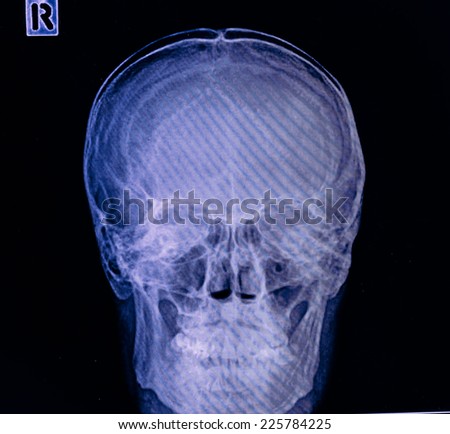 detail of head x-ray image