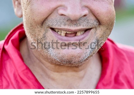 Toothless smile of an elderly unshaven man from Eastern Europe. Royalty-Free Stock Photo #2257899655