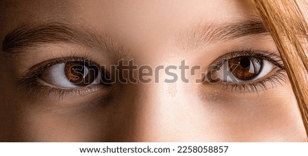 Strabismus. Close-up part child's face, eyes girl. Little patient strabismus, treatment ophthalmic diseases. Strabismus in children causes, treatment concept. Female eyes with strabismus. Hypertropia. Royalty-Free Stock Photo #2258058857