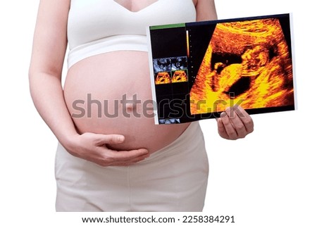 A pregnant woman holds an ultrasound with an unborn child, a studio photo, isolated on a white background