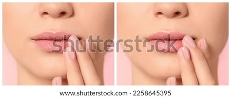 Collage with photos of woman before and after using lip balm on pink background, closeup Royalty-Free Stock Photo #2258645395
