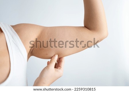 Cropped shot of a young woman with excess fat on her upper arm with marks for liposuction or plastic surgery isolated on a gray background. The loose and saggy muscles. Overweight Royalty-Free Stock Photo #2259310815