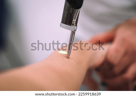 Close up shot of gloved hand with the laser hair removal machine's handpiece along woman hand. Alexandrite laser techhnology removing hair. Beauty procedureBeauty technology concept